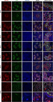 Dynamics of HSD17B3 expression in human fetal testis: implications for the role of Sertoli cells in fetal testosterone biosynthesis